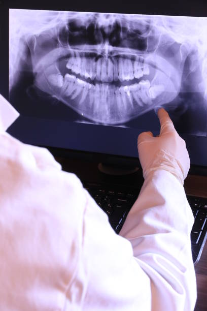 Best Emergency Dental Care for Broken or Chipped Teeth in Notre Dame, IN